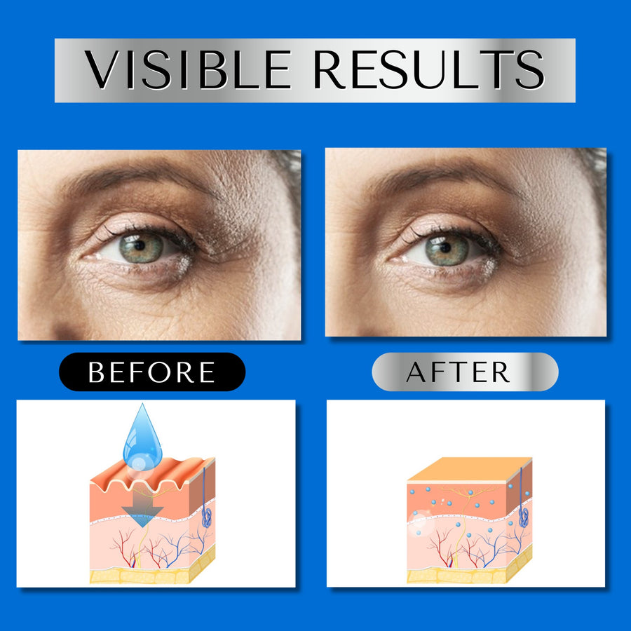 Dermaworks hydrating Hyaluronic Acid helps reduce the visibility of fine lines and wrinkles and boosts your complexion. Get visible results within just a few weeks.
