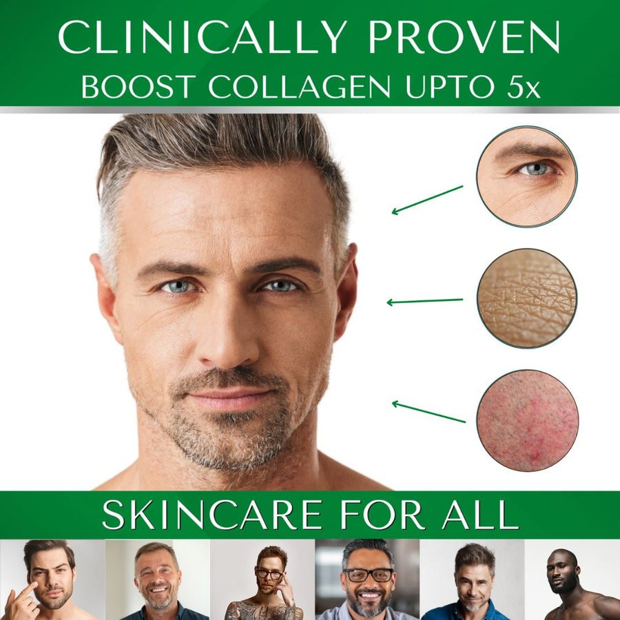 Side-by-side before and after of a man’s skin using retinol, showing smoother skin and visibly improved texture, with text stating it boosts collagen by 4×