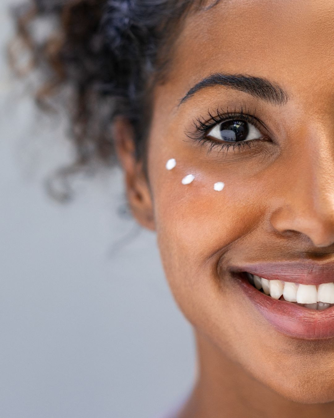 How can Retinol Serum Help with Dark Circles?
