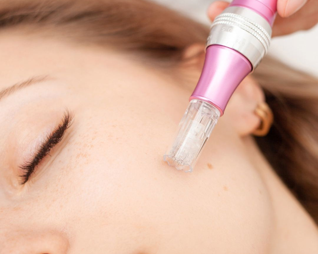 How do you take care of your skin after microneedling? 