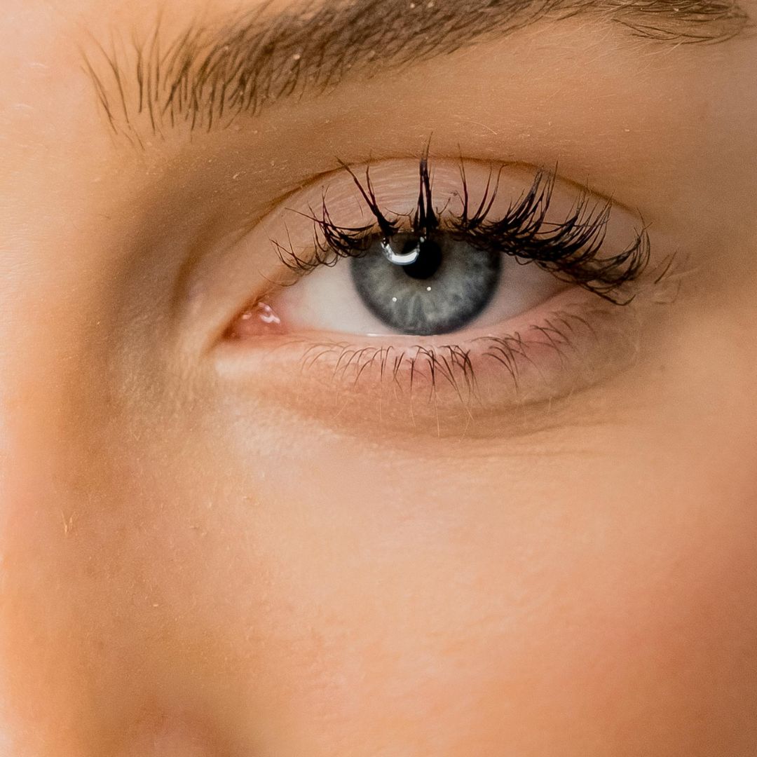 How to Get Rid of Eye Bags Fast: 9 Tips That Actually Work