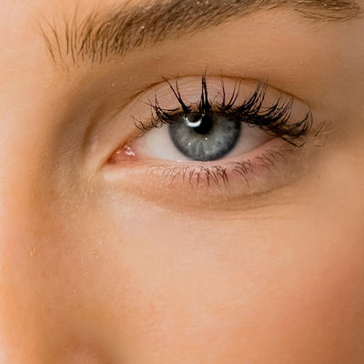 How to Get Rid of Eye Bags Fast: 9 Tips That Actually Work