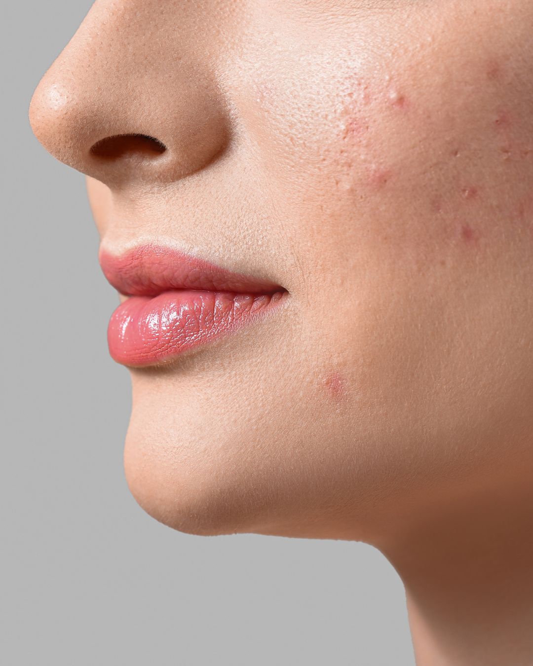 How to Minimise Pores