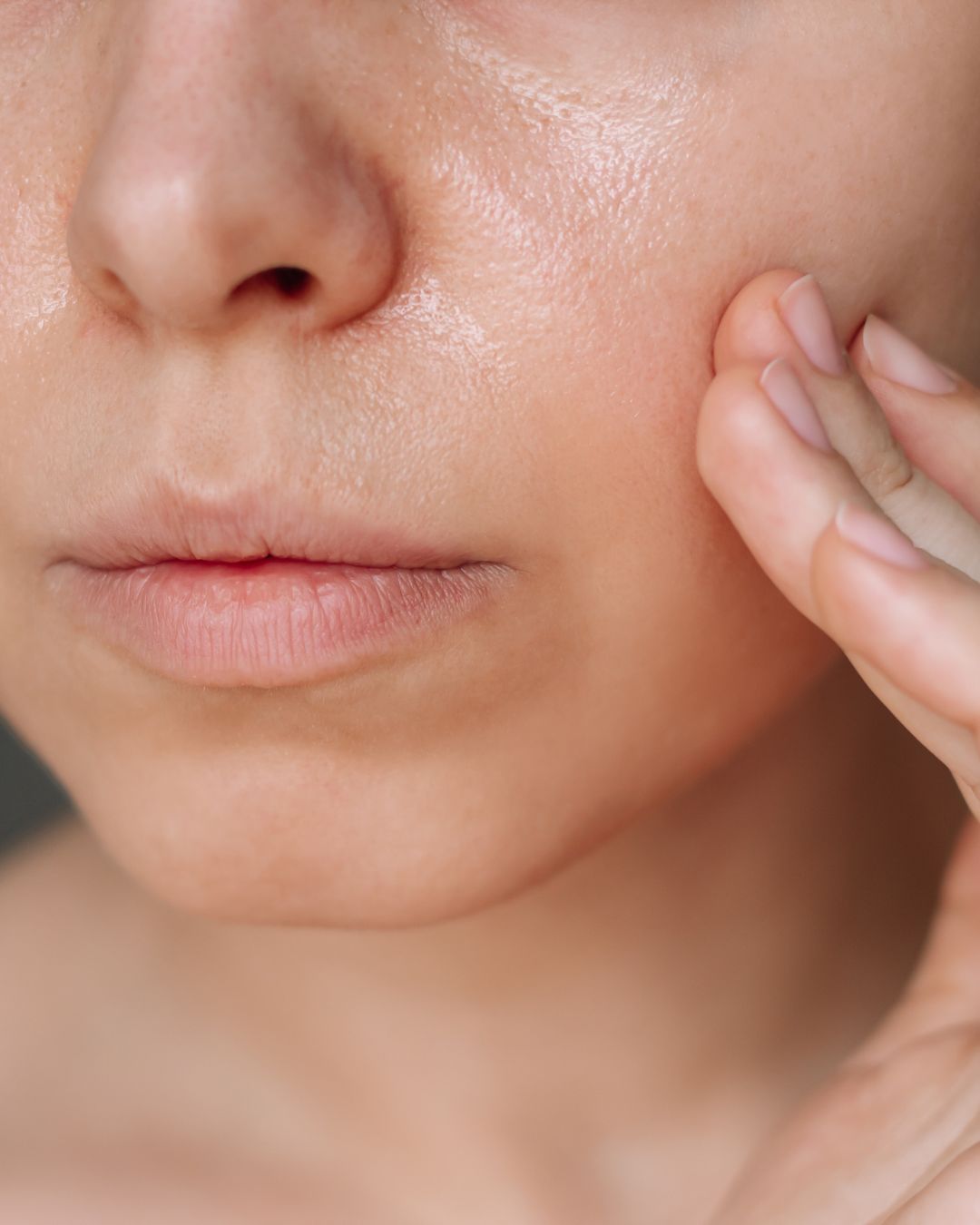 How to Repair Your Skin Barrier Naturally: Dermatologist-Backed Tips