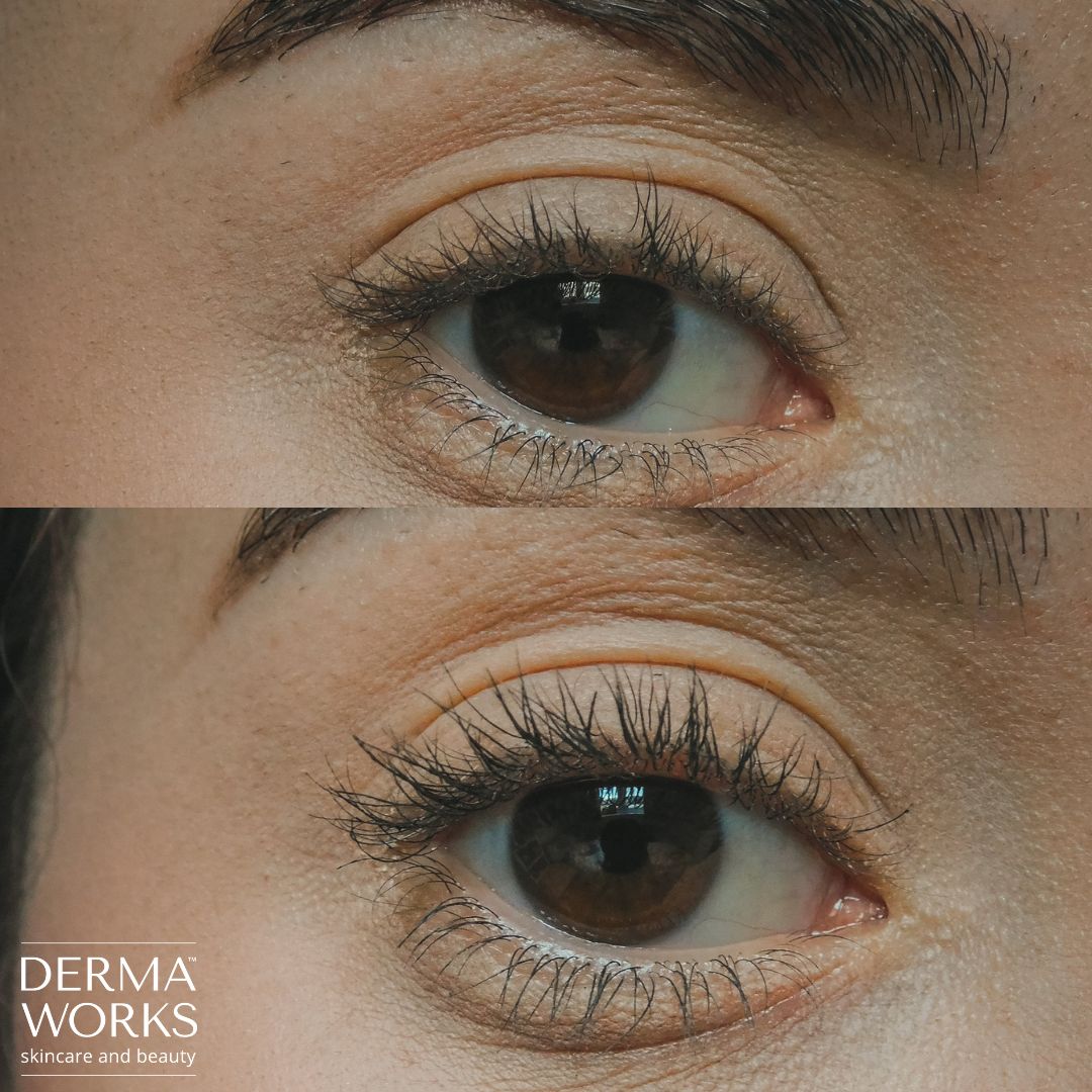 when does lash serum start working