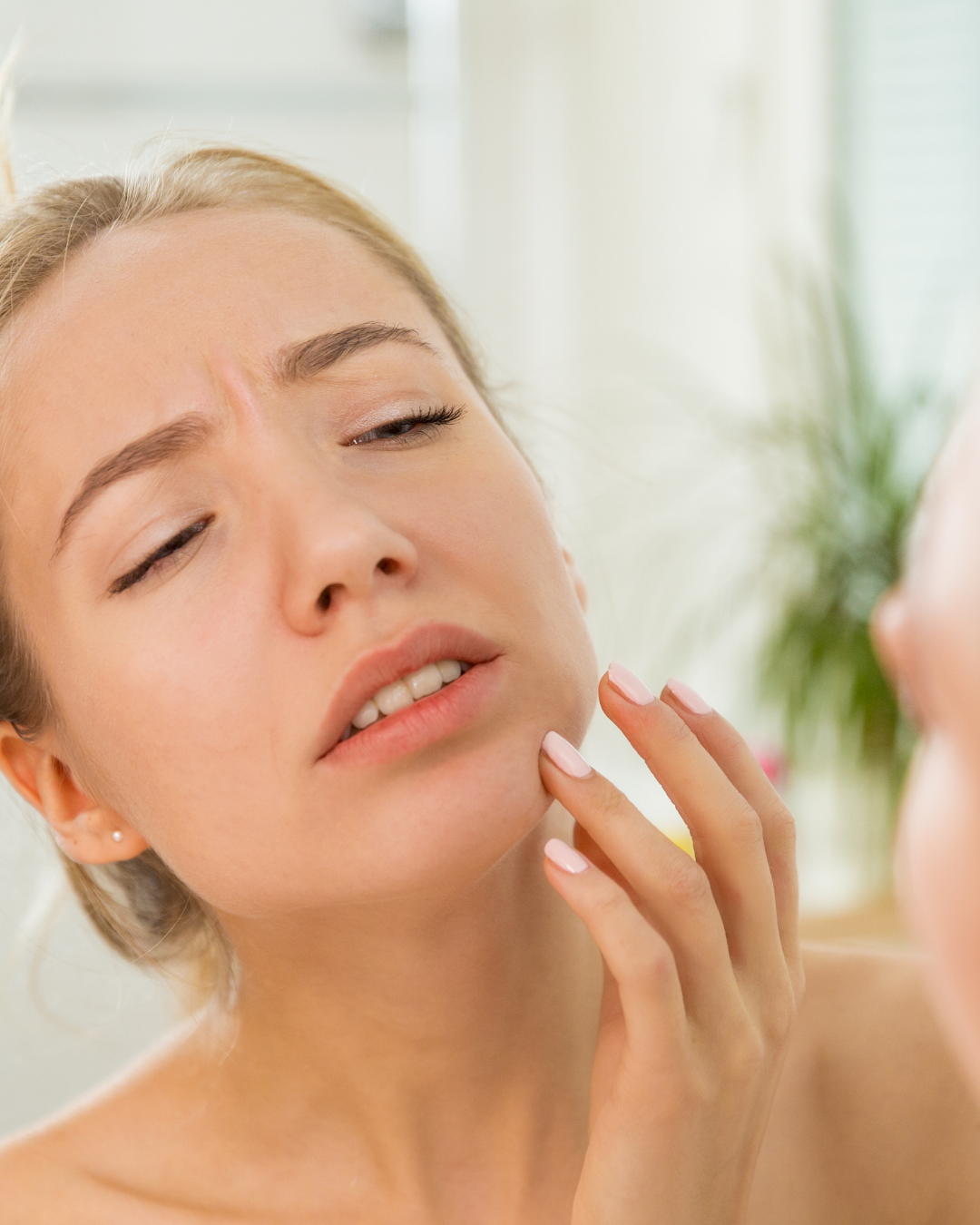 Will retinol help acne?