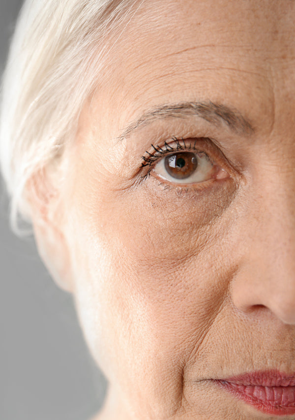 Before transformation 1