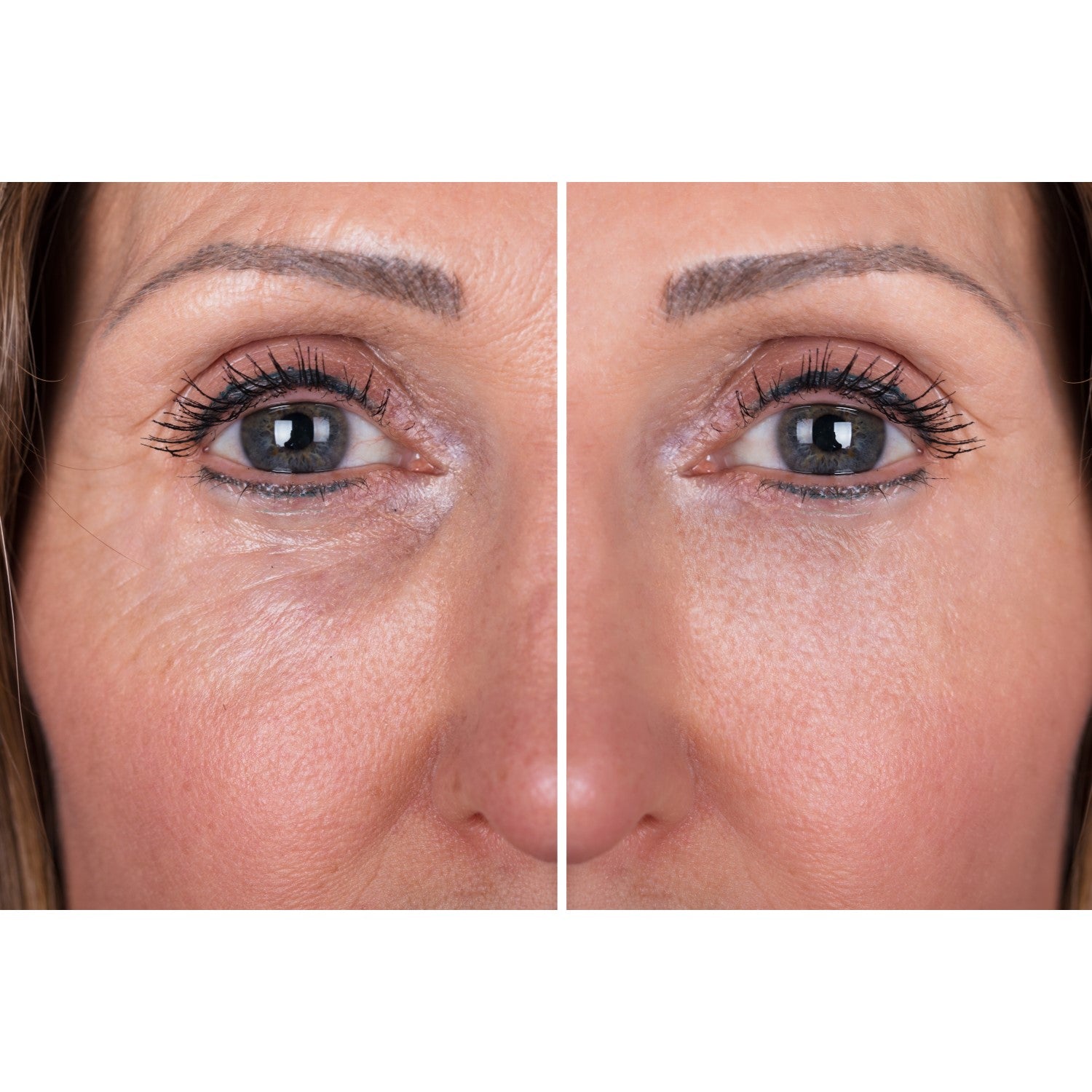 Before and after of lines and wrinkles using Immaculift instant eye lift serum. Immaculift reduces wrinkles, pore size and eye bags, and tightens sagging skin.
