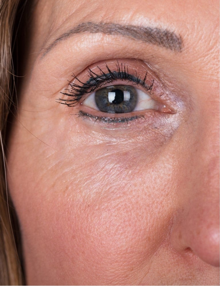 Before and after of lines and wrinkles using Immaculift instant eye lift serum. Immaculift reduces wrinkles, pore size and eye bags, and tightens sagging skin.