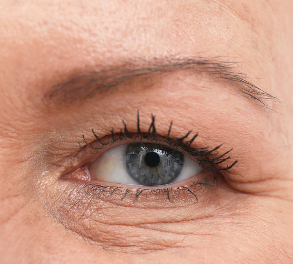 Before transformation 2