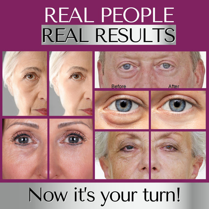 Before and after results of Immaculift instant eye lift serum showing reduced puffiness and fine lines