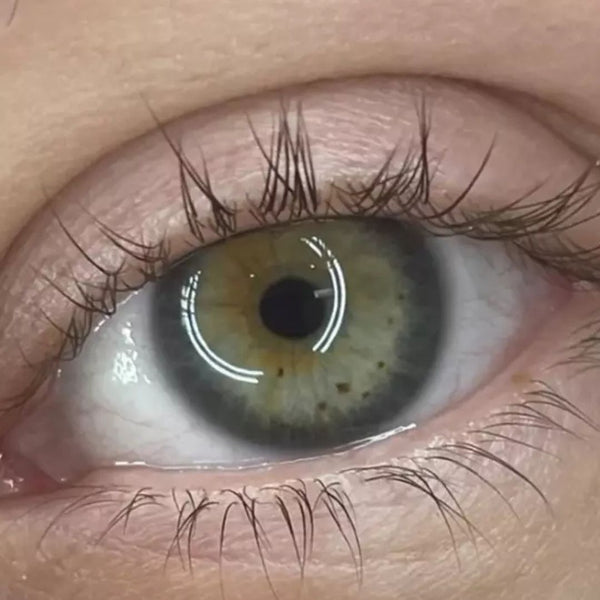 Before transformation 2