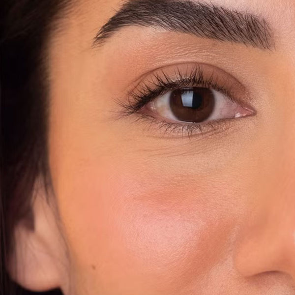 Before transformation 1